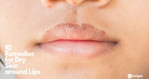 10 Remedies for Dry Skin around Lips