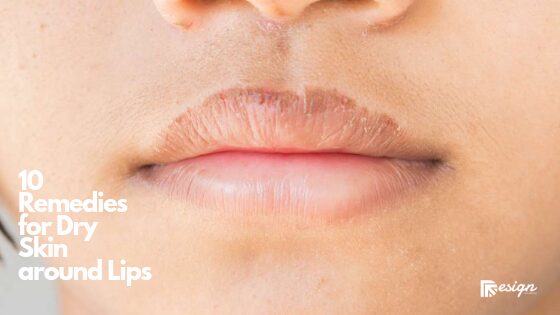 10 Remedies for Dry Skin around Lips