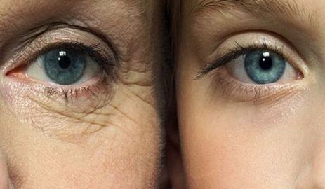 6 Tips that help to remove under-eye lines and wrinkles