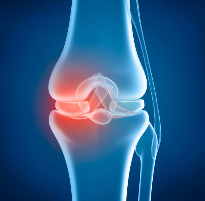 how-long-does-it-take-to-recover-after-double-knee-replacement-surgery