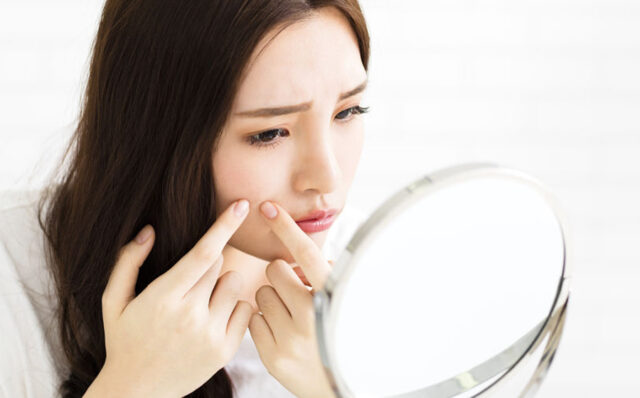 Pre-treatment for pimples and acne