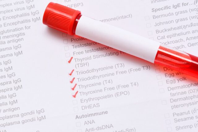 Subclinical Hypothyroidism