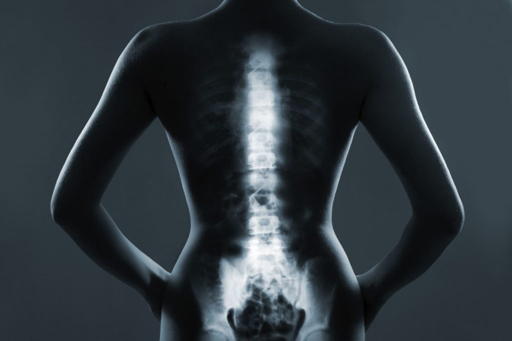 What Are The Symptoms Of Back Cancer 2022 Guide Ferguson Action 2022
