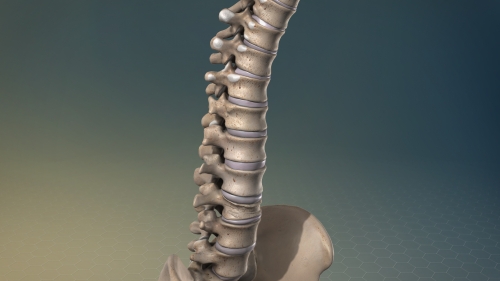 What causes degenerative disc disease