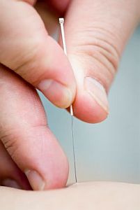 acupuncture concentrates
