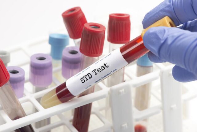 Different Types Of STI Tests Ferguson Action 2024